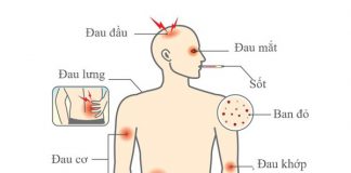 Bệnh Sốt Xuất Huyết – Dấu Hiệu, Triệu Trứng sốt xuất huyết