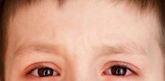 Những thông tin về bệnh đau mắt đỏ nên biết ? dau mat do