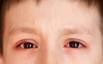 Những thông tin về bệnh đau mắt đỏ nên biết ? dau mat do