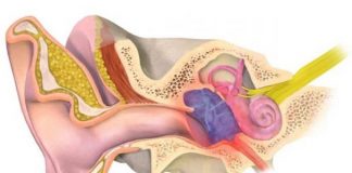 Ù tai có thể do thiếu vi chất này viem tai giua