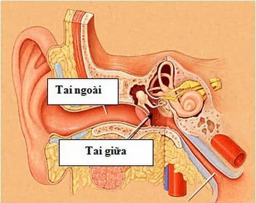 Bệnh viêm tai giữa là gì?